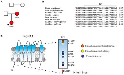 Frontiers Case Report A Novel Loss Of Function Pathogenic Variant In